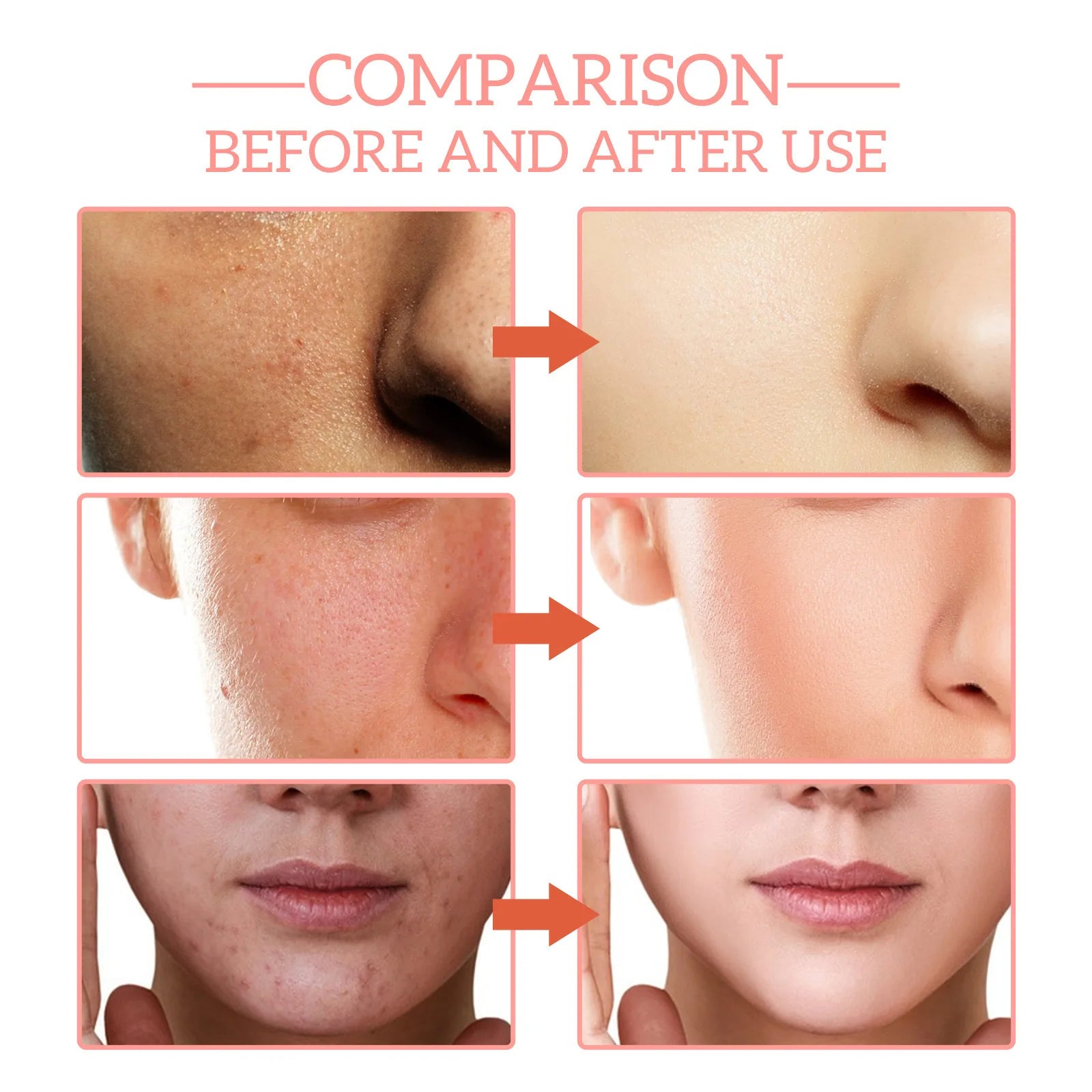 5 In 1 Fade fine lines Firming Face Serum Moisturizing brightning Vitamin C Hyaluronic Acid Facial Serum Shrink Pores Skin Care
