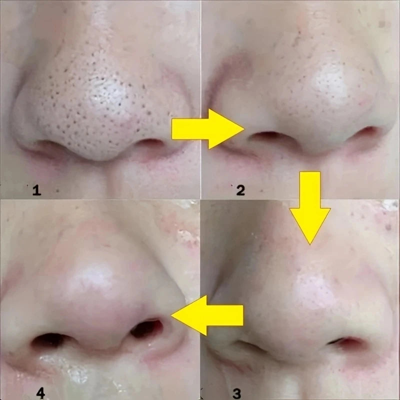 Unisex Deep Cleansing Nose Strips for Acne & Blackhead Removal Shrink Pore Nose Black Head Stickers Skin Care Patch