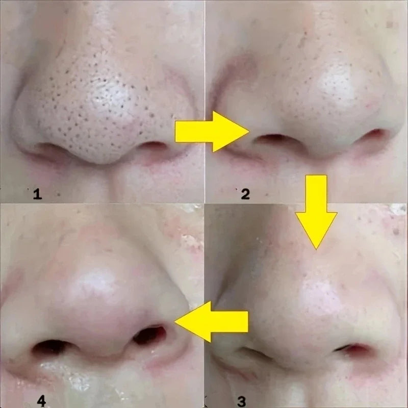Unisex Deep Cleansing Nose Strips for Acne & Blackhead Removal Shrink Pore Nose Black Head Stickers Skin Care Patch